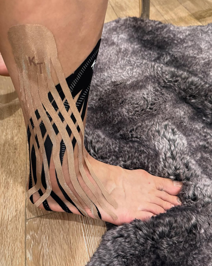 Lâm Bảo Châu được băng bó cổ chân cẩn thận sau khi gặp chấn thương. Ảnh: IGNV