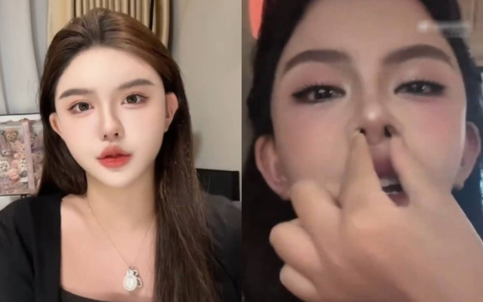 Ngôi sao mạng phải dùng tay nong mũi để dễ thở vì 'dao kéo' quá nhiều Ảnh 2