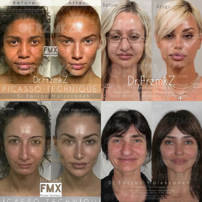 Tranh cãi xung quanh vụ phẫu thuật thẩm mỹ siêu đẳng: Thực tế hay photoshop? Ảnh 4