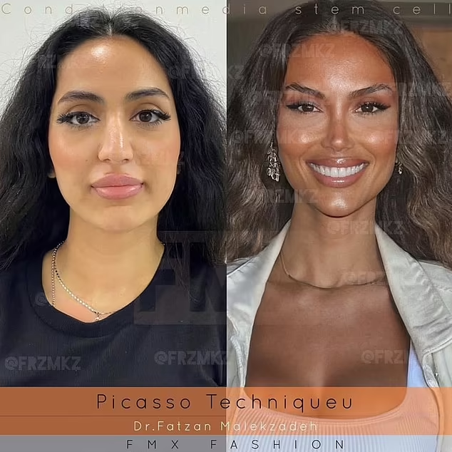 Tranh cãi xung quanh vụ phẫu thuật thẩm mỹ siêu đẳng: Thực tế hay photoshop? Ảnh 3