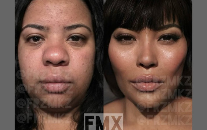 Tranh cãi xung quanh vụ phẫu thuật thẩm mỹ siêu đẳng: Thực tế hay photoshop? Ảnh 2