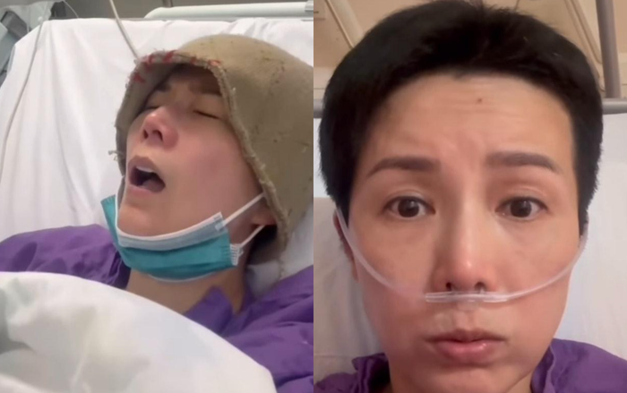 Gương mặt hốc hác, tiều tụy của nữ diễn viên khi điều trị ung thư khiến nhiều người xót xa. (Ảnh: 163)
