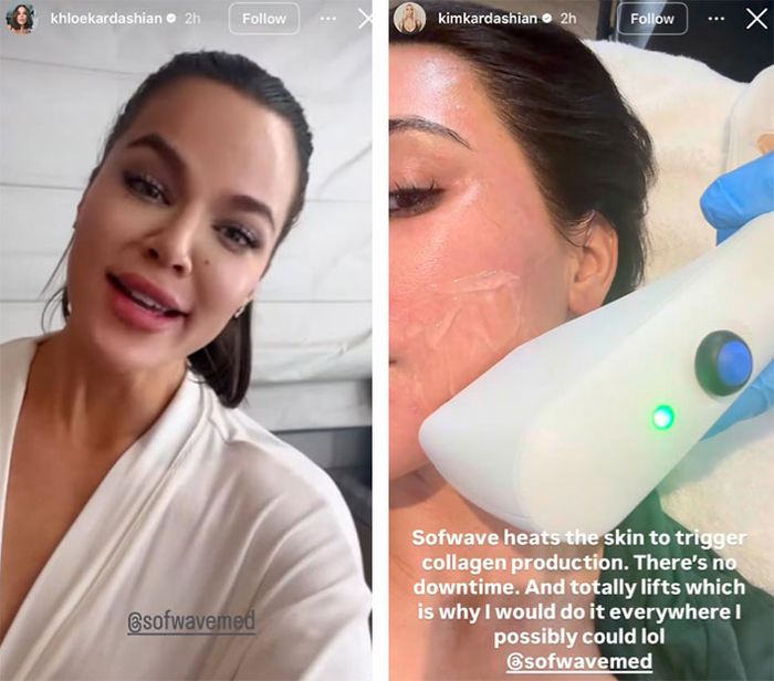 Công nghệ căng da 'không xâm lấn' được Kim Kardashian tín nhiệm: Liệu có thực sự hiệu quả? Ảnh 1