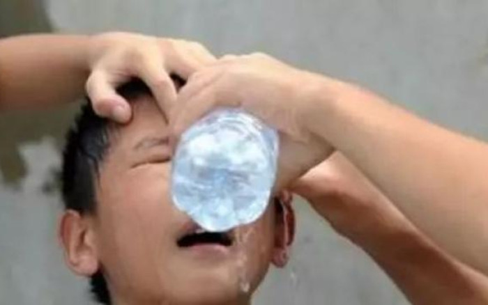 Vừa quay đi 15 phút, người mẹ trở lại thì phát hiện con trai bị mù sau khi ăn vặt Ảnh 2