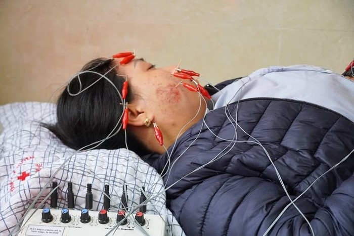 Liệt mặt biến chứng do thời tiết lạnh vô cùng nguy hiểm