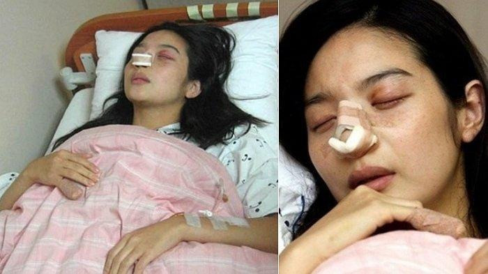 Nữ diễn viên nhập viện vì bị chồng tác động vật lý. (Ảnh Chosun Daily)