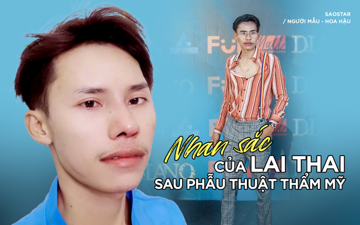 Bất ngờ với nhan sắc của Lai Thai sau khi phẫu thuật thẩm mỹ ở Việt Nam Ảnh 2
