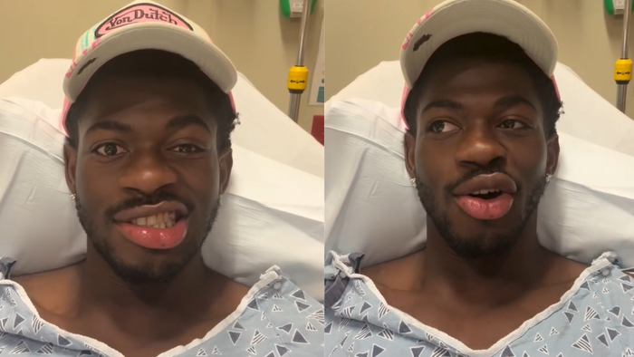 Rapper Lil Nas X bị liệt nửa mặt Ảnh 1