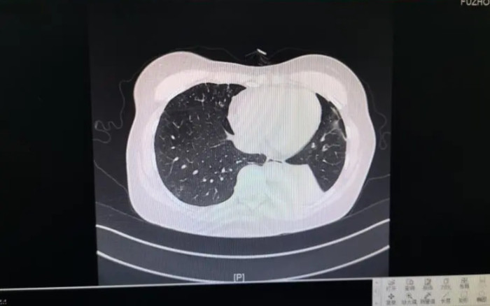 Người phụ nữ đang xếp quần áo bỗng sốt cao, kết luận của bác sĩ gây bất ngờ Ảnh 2