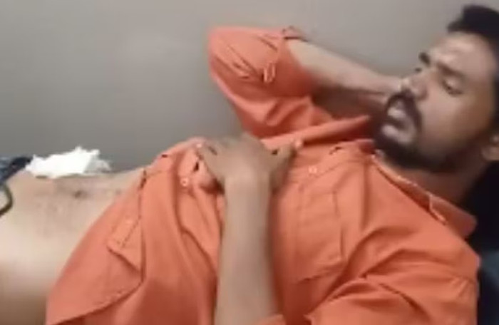 Người đàn ông lên mạng học cách tự mổ ruột thừa tại nhà, gặp biến chứng nghiêm trọng sau đó Ảnh 1