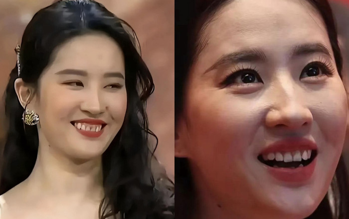 Những lần sao Hoa Ngữ khiến fan 'quay xe' vì nhan sắc trượt dốc Ảnh 2