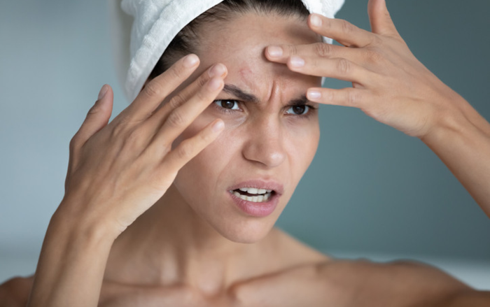 Khi stress là 'kẻ thù thầm lặng' của làn da: Hãy ngừng phớt lờ nó Ảnh 1