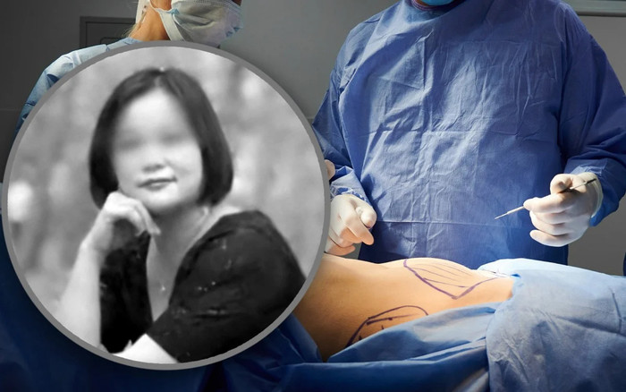 Người phụ nữ 'ra đi' sau khi mượn nợ để dao kéo 6 lần/ngày Ảnh 2