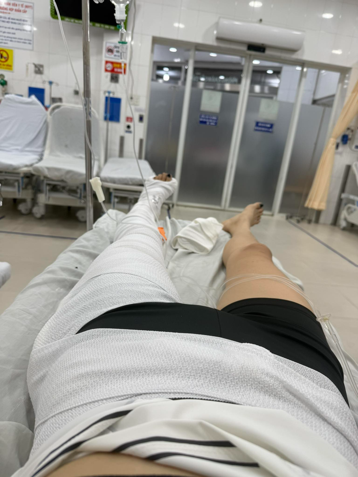 Vợ Mạc Hồng Quân nhập viện vì gãy xương đùi do luyện tập thể thao.