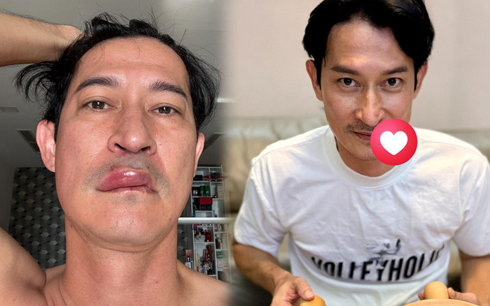 Tình trạng hiện tại của Huy Khánh sau biến cố sức khỏe Ảnh 2