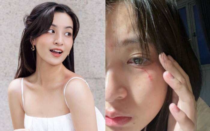 Sao nữ Vbiz bị thú cưng 'tấn công', tình trạng gây xót xa Ảnh 2