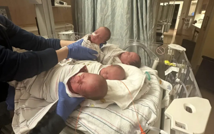 Người phụ nữ mang thai 4 con một lúc, kết quả sinh nở đầy mỹ mãn Ảnh 2