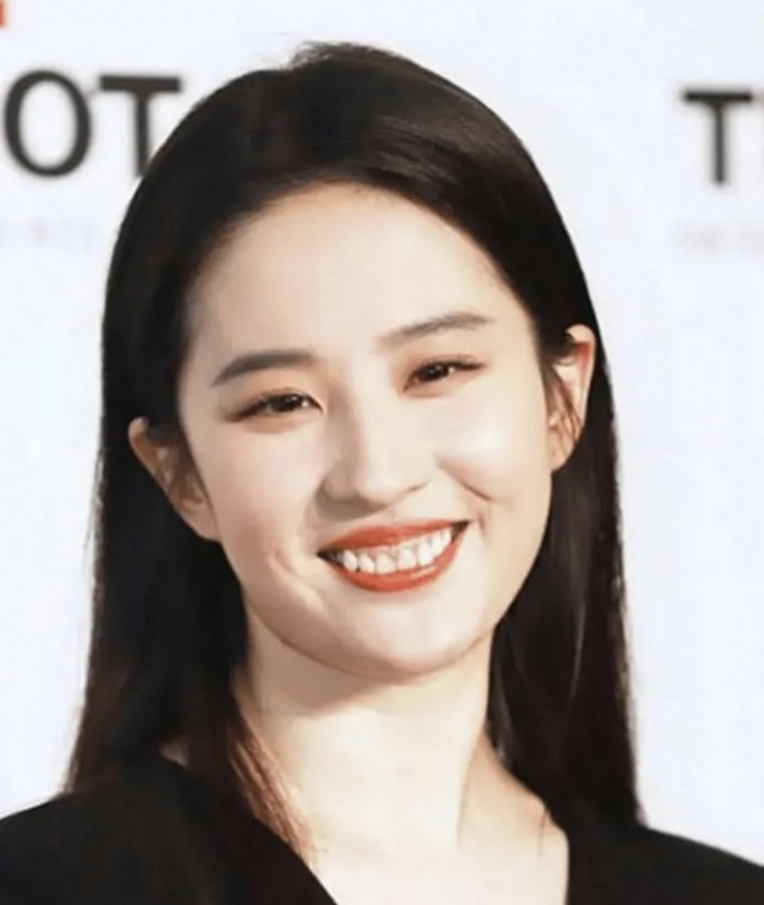 Nguyên nhân khiến nụ cười của Lưu Diệc Phi bị đánh giá kém duyên là do hàm răng không đều và hở lợi. Ảnh: Weibo