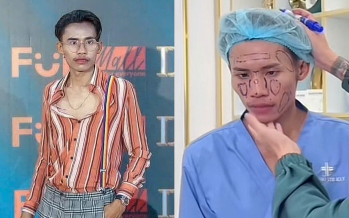 Lai Thai bật khóc khi được phẫu thuật thẩm mỹ ở Việt Nam Ảnh 2