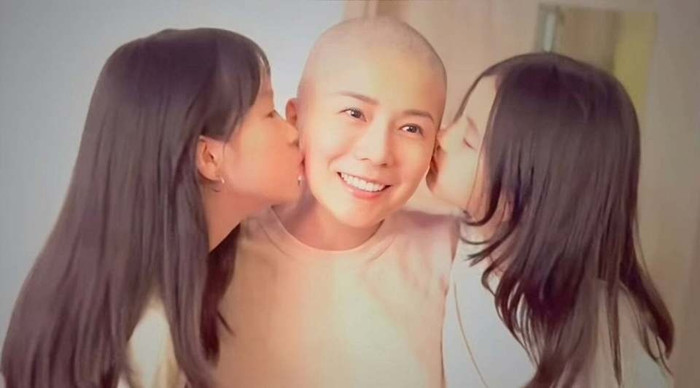 Ngô Văn Hân phải cạo đầu trong quá trình điều trị ung thư. (Ảnh QQ)