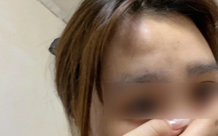 Thông tin mới vụ nữ sinh viên bị đánh vì nhận được tiền 'bo' Ảnh 2