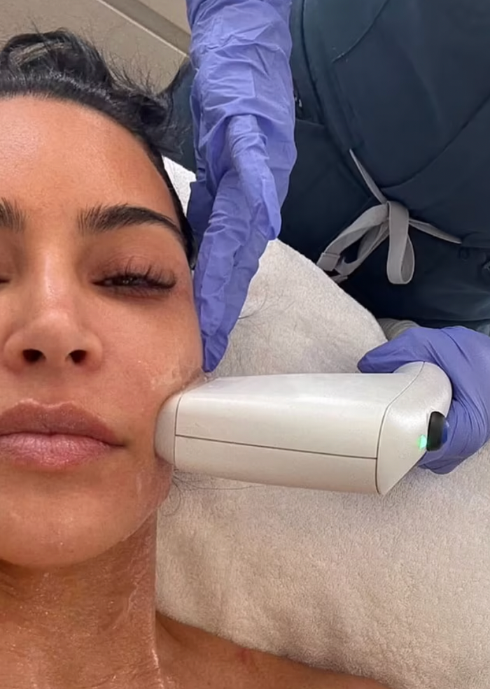 Kim Kardashian chi hơn 100 triệu đồng thực hiện chăm sóc da không xâm lấn, để có diện mạo thu hút nhất tại Met Gala 2025. (Ảnh chụp màn hình)