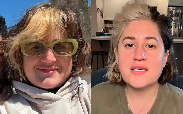 Michaela Lassig đã đặt lịch tiêm tan má, tiêm botox và liệu pháp laser EndoLift sau khi được AI tư vấn. (Ảnh: Daily Mail)