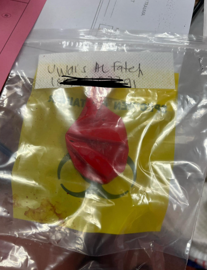 Chơi trò ném bóng bay cùng bạn trong tiệc sinh nhật, bé trai nguy kịch ngay sau đó Ảnh 2