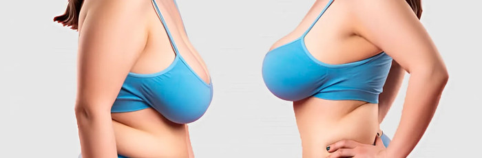 Phẫu thuật thu nhỏ vòng 1 là phương pháp được Zara Armstrong lựa chọn, bất chấp những rùi ro. (Ảnh minh họa)