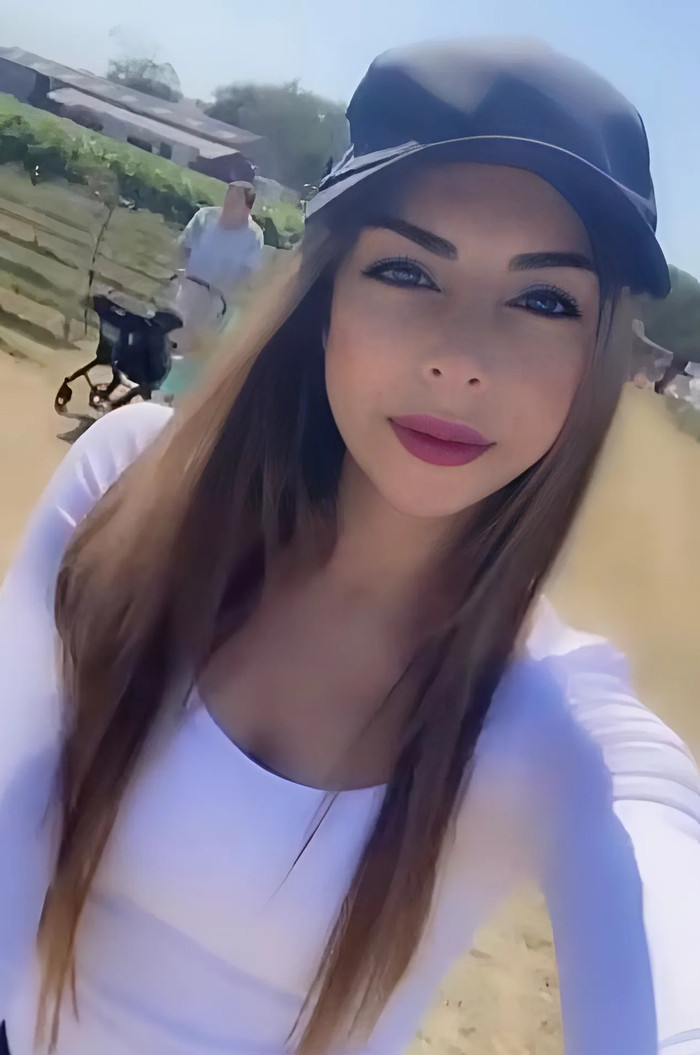 Maryum Mohammad gặp vấn đề nghiêm trọng sau khi filler. (Ảnh: Daily Mail)