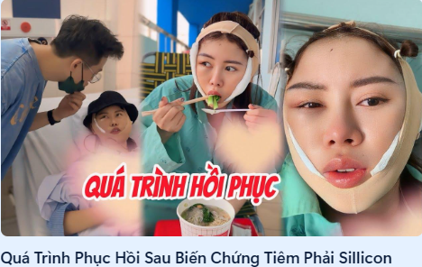 (Ảnh chụp màn hình từ vlog của TikToker Việt Phương Thoa, nơi cô chia sẻ chi tiết về quá trình phục hồi sau biến chứng tiêm silicon)