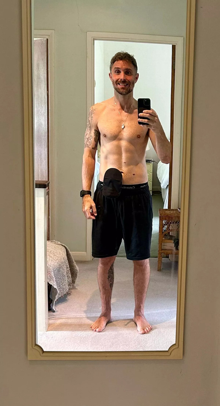 Andy Spary giữ tinh thần lạc quan và tiếp tục điều trị bệnh. (Ảnh: Mirror)