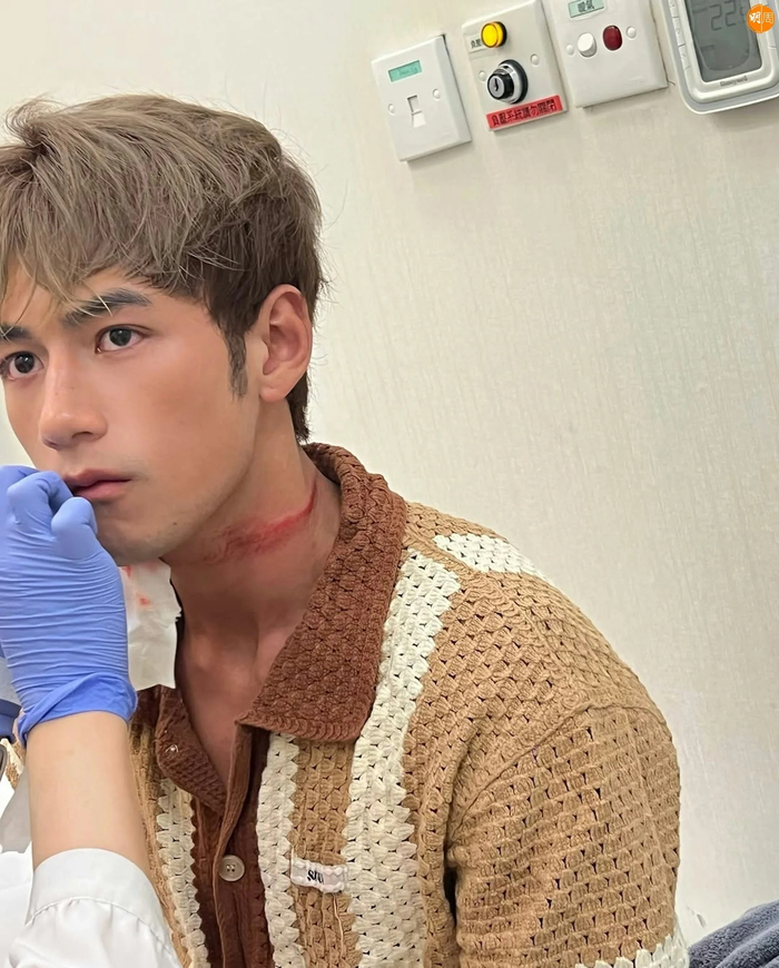 Nam diễn viên Ngụy Tuấn Sênh sau đó được đưa đến bệnh viện để kiểm tra.