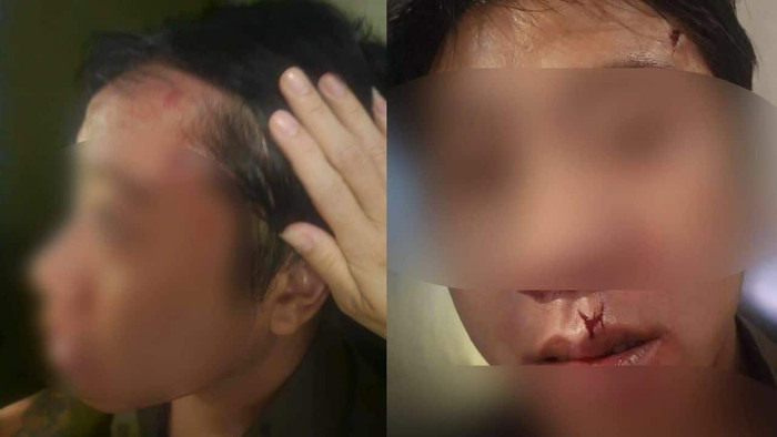 Nam ca sĩ bị đánh rách môi khi đang hát, đoạn clip ghi lại sự việc ai xem cũng phẫn nộ Ảnh 2