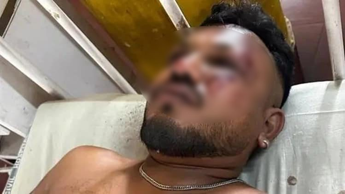 Vishwash - người may mắn sống sót sau vụ tai nạn rơi máy bay ở Ấn Độ mới đây. Được biết, anh ngồi ở ghế số 11A trên chuyến bay xấu số. (Ảnh: Hisdustan Times)