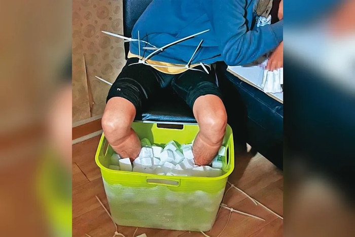 Nam sinh viên ngâm chân trong đá khô suốt 10 tiếng để trục lợi bảo hiểm, hậu quả đau lòng Ảnh 1