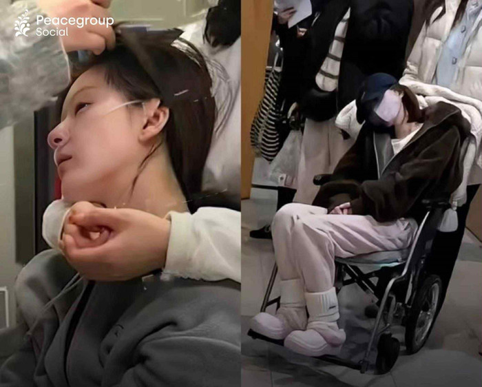 Triệu Lộ Tư trong giai đoạn sức khỏe cô tổn hại nghiêm trọng. Ảnh: Peacegroup Social