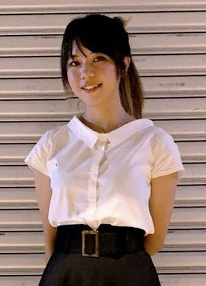 Cô gái 28 tuổi hóa thành bà cụ già sau 7 tháng mang thai, xem ảnh ai cũng giật mình Ảnh 1