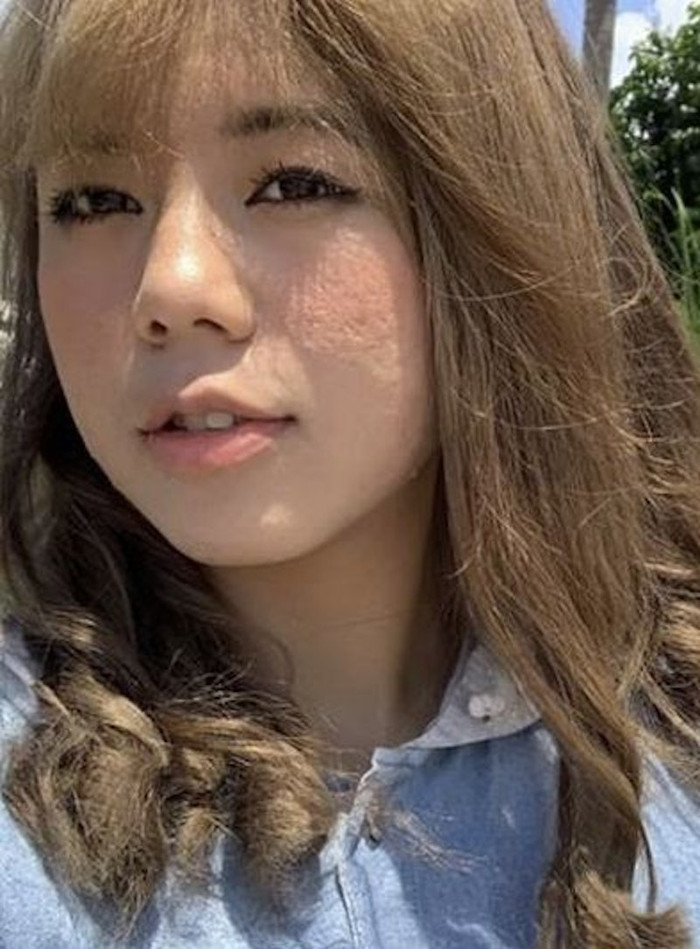 Cô gái 28 tuổi hóa thành bà cụ già sau 7 tháng mang thai, xem ảnh ai cũng giật mình Ảnh 2