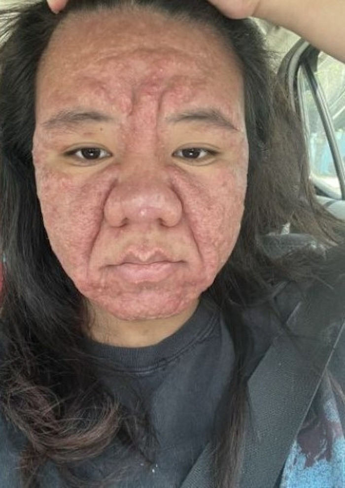 Cô gái 28 tuổi hóa thành bà cụ già sau 7 tháng mang thai, xem ảnh ai cũng giật mình Ảnh 3