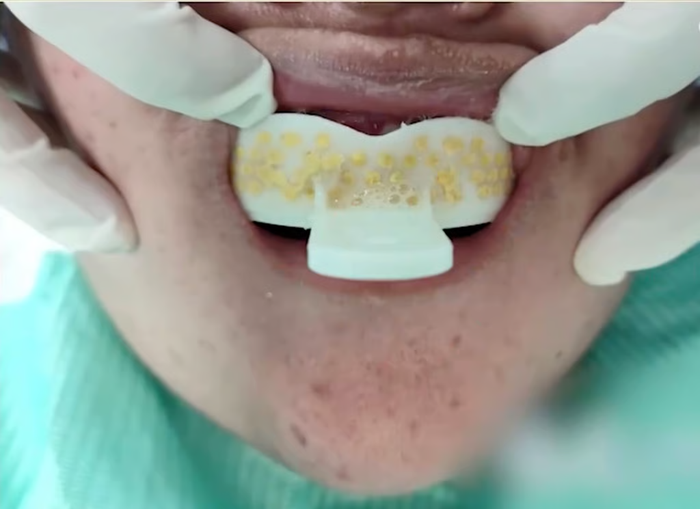 Tự làm hàm duy trì tại nhà, cô gái 24 tuổi gặp nguy hiểm đến tính mạng Ảnh 1