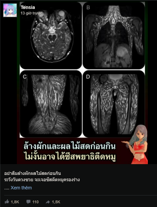 Ăn rau sống, cô gái bị sán dây lợn 'xâm chiếm' cơ thể Ảnh 2