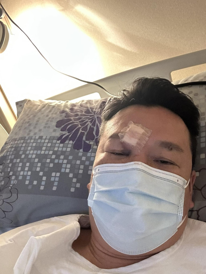 Nam ca sĩ gặp tai nạn xe trên đường đi làm, gương mặt bị thương nghiêm trọng Ảnh 2