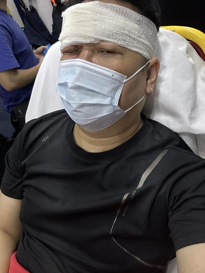 Nam ca sĩ gặp tai nạn xe trên đường đi làm, gương mặt bị thương nghiêm trọng Ảnh 1