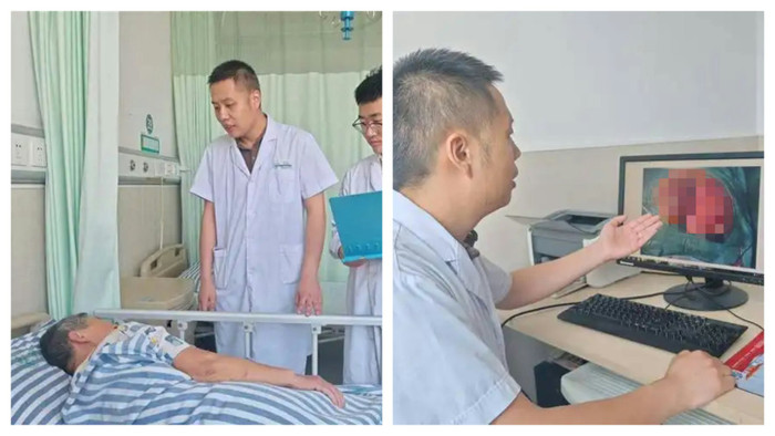 Ngồi lên tảng đá giữa trời nắng để nghỉ mệt, bà cụ bị bỏng mông nặng phải ghép da Ảnh 2