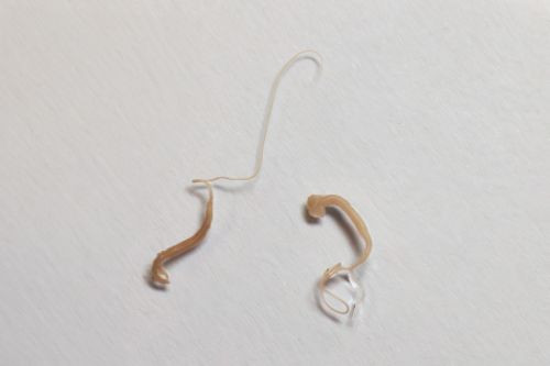 Bé gái liên tục tiêu chảy ra máu, bác sĩ 'rụng rời' sau khi nội soi Ảnh 3