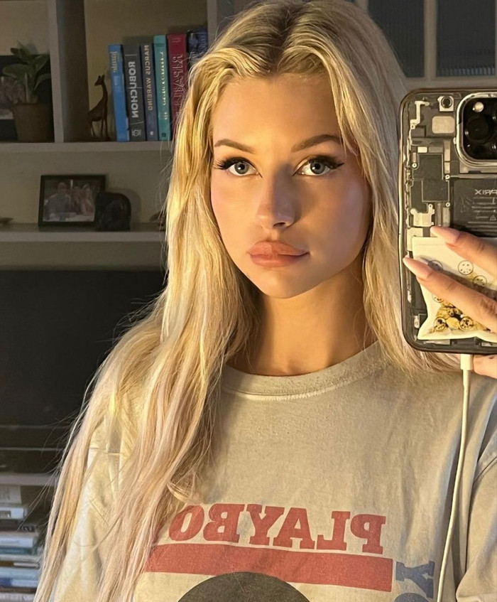 'Tôi có chút bầm ở môi vì đang tan filler, nhưng cuối cùng đã thấy mình trở về đúng chính mình.' (Ảnh: Instagram Lottie Moss)