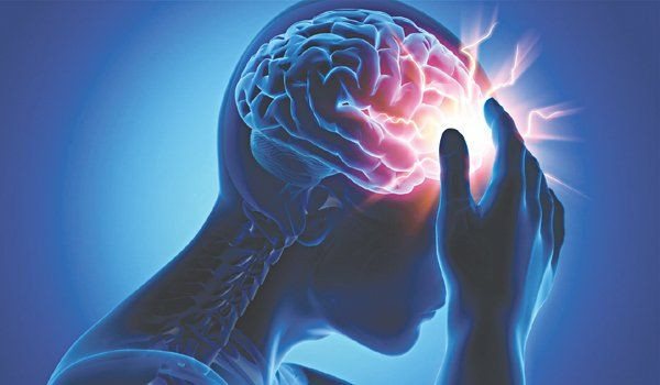 Căn bệnh đột quỵ ngày càng trẻ hoá. Ảnh minh hoạ
