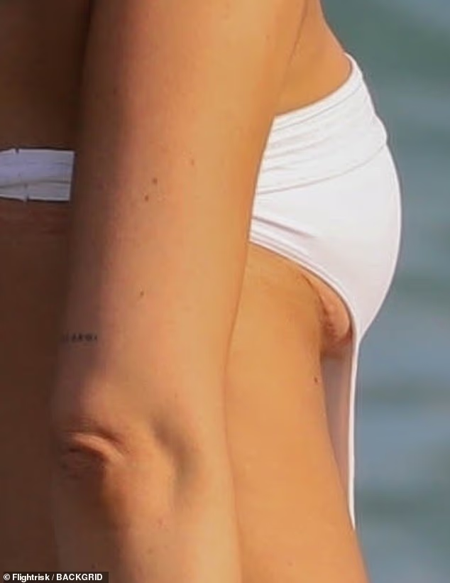 Vết sẹo của ngôi sao truyền hình đã vô tình lộ rõ trong loạt ảnh paparazzi, khiến người hâm mộ không khỏi giật mình. (Ảnh: Flightrisk)