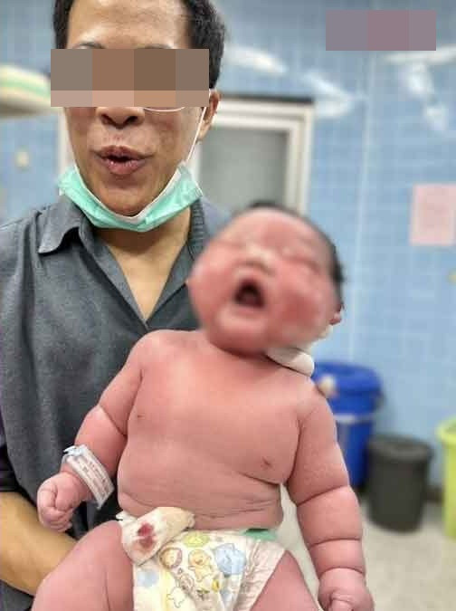 Sản phụ sinh ra em bé 'khổng lồ' khiến cả bệnh viện xôn xao Ảnh 2